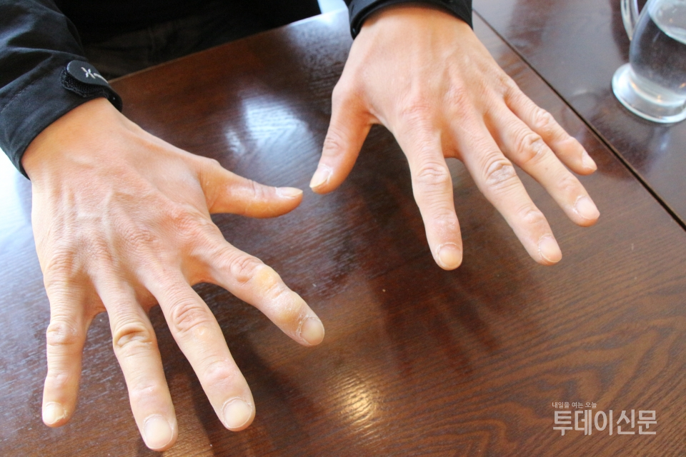 탠디 하청업체 제화공 박완규씨가 굳은살이 박힌 손을 보여주고 있다.
