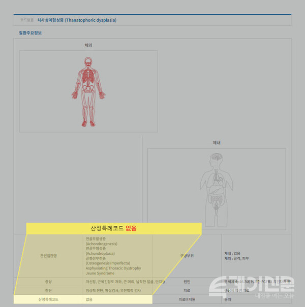 희귀병인 치사성이형성증은 보건복지부 산정특례코드가 지정돼 있지 않다 ⓒ투데이신문
